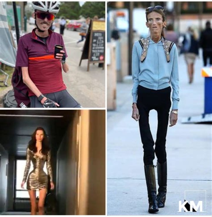 Discovering the Skinniest Person: A Journey Through Facts and Stories